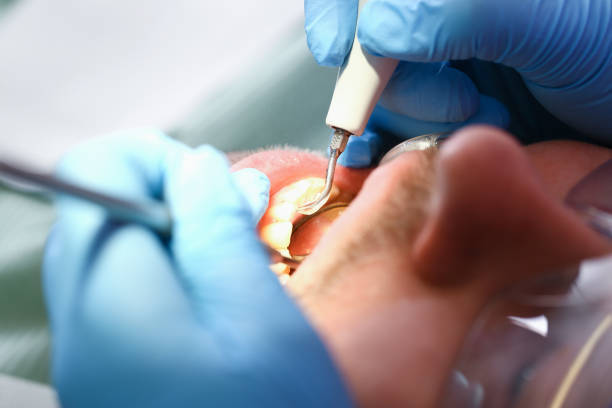 Best Emergency Dentist for Knocked-Out Tooth in Franklin, CA