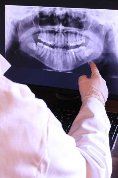 Best Emergency Dental Extractions in Franklin, CA