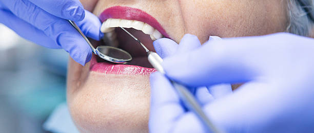 Best Emergency Dental Care for Abscessed Tooth in Franklin, CA